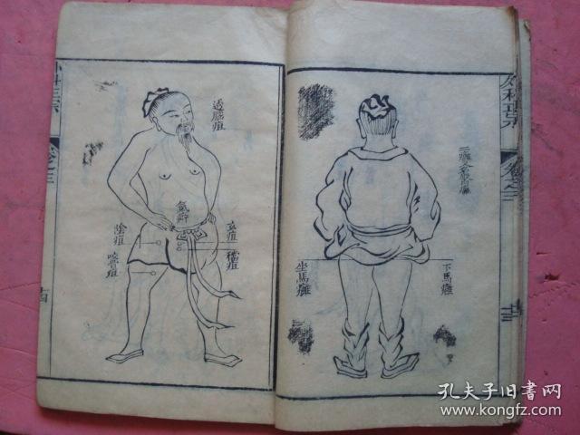 4 二本合卖)(痈疽图式,疔疮论,脑疽论,婴儿妇人等图36幅,附外科诸证疮