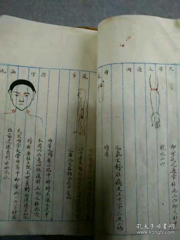 手抄医术及针灸法 日医万病针灸全书 阴缩法 治尸厥法