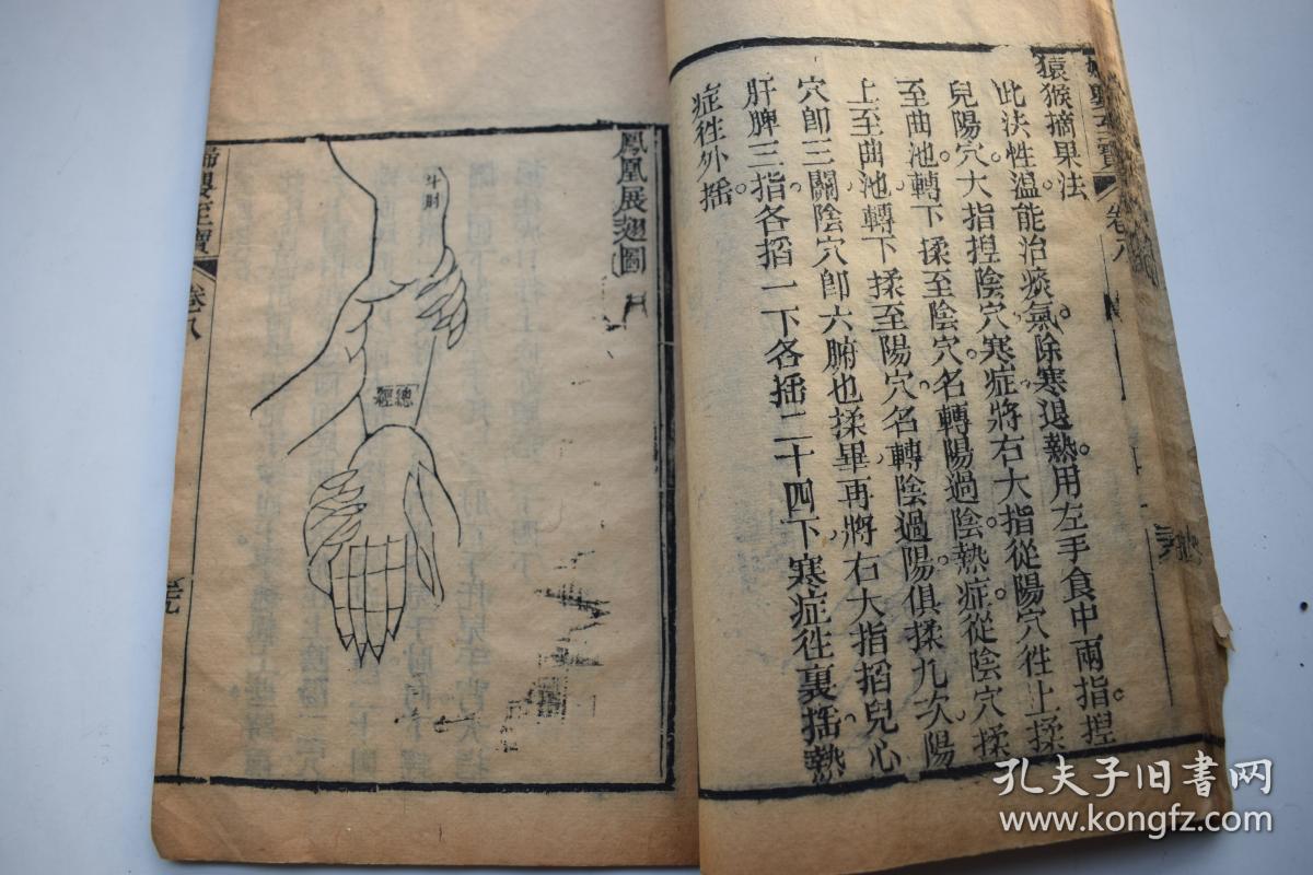 原装一册,卷八有大量图版:正面诸穴图,阳掌图,阴掌图,正面全身图,男左