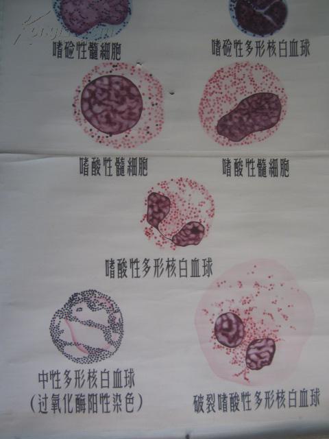 5-60年代 手绘 山东医学院挂图一张 小儿科-粒细胞系统 尺寸149*103