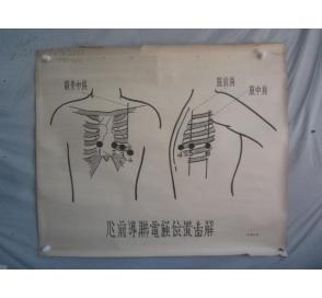 5-60年代 手绘 山东医学院挂图一张 心前导联电极位置图解 尺寸103*75