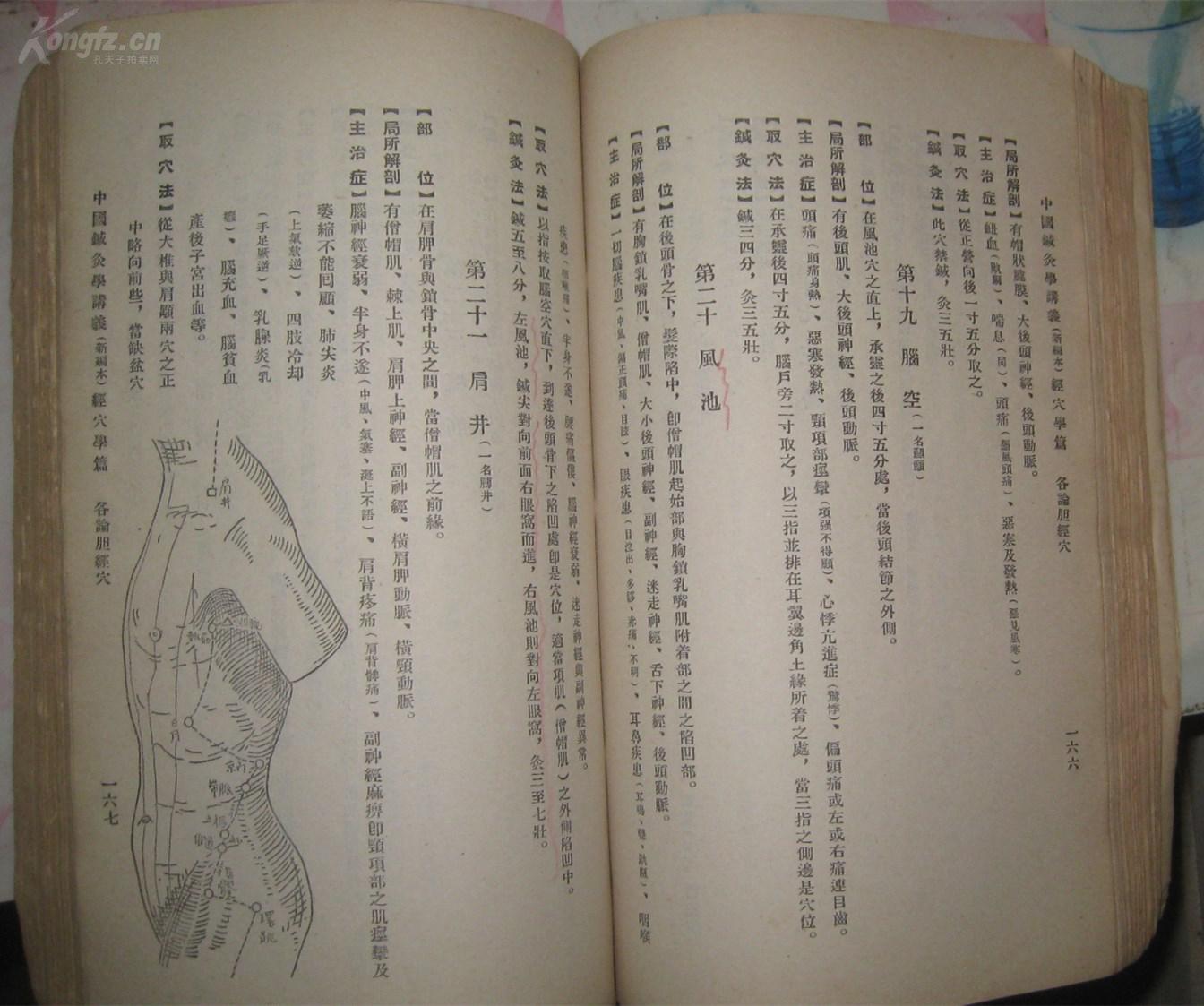 打了曲谱瑞林针要多久恢复促排_打吊针图片(4)