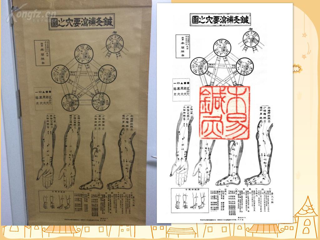 针灸补和泻是什么原理_针灸补泻手法图解(2)
