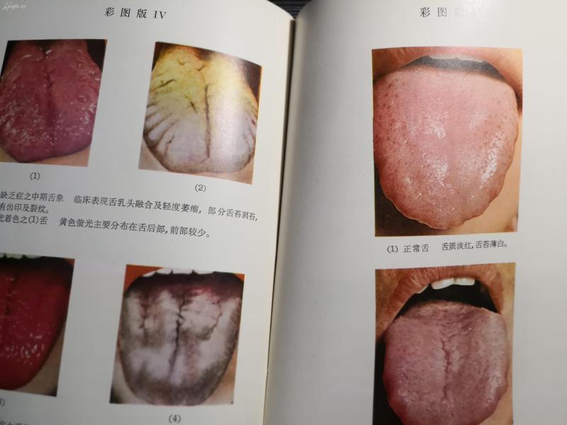 初版补充再版 ,附彩色照片图百余幅,及前人舌诊文献--中医名家吴坤安