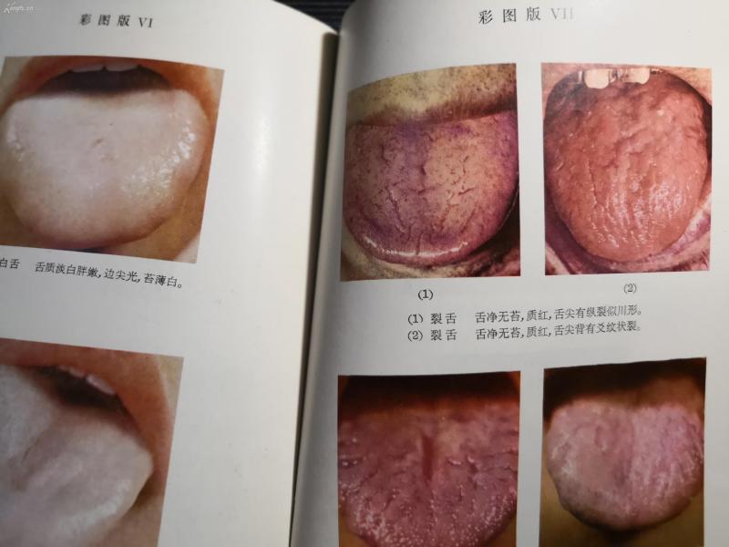 初版补充再版 ,附彩色照片图百余幅,及前人舌诊文献--中医名家吴坤安