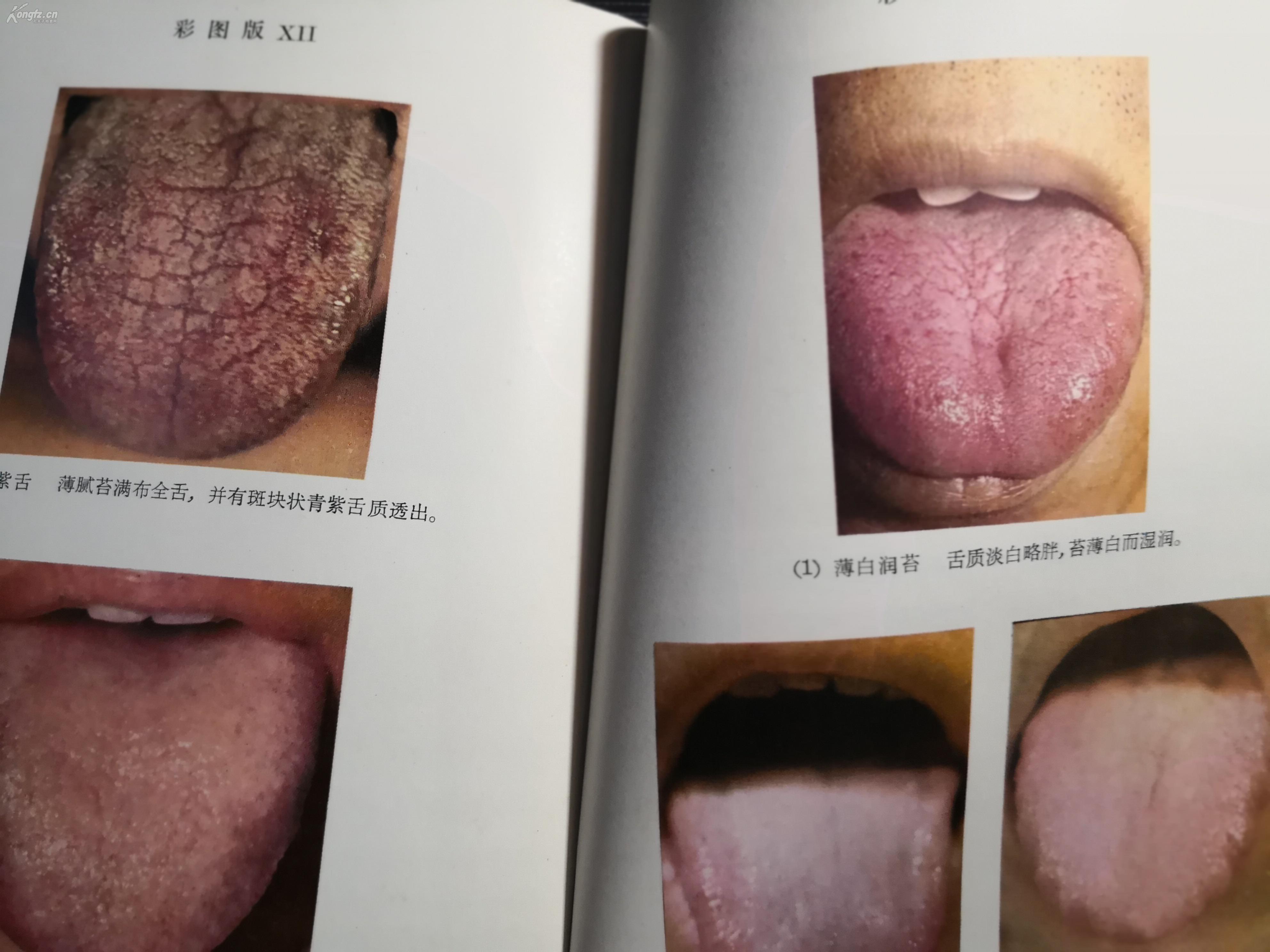 初版补充再版 ,附彩色照片图百余幅,及前人舌诊文献--中医名家吴坤安