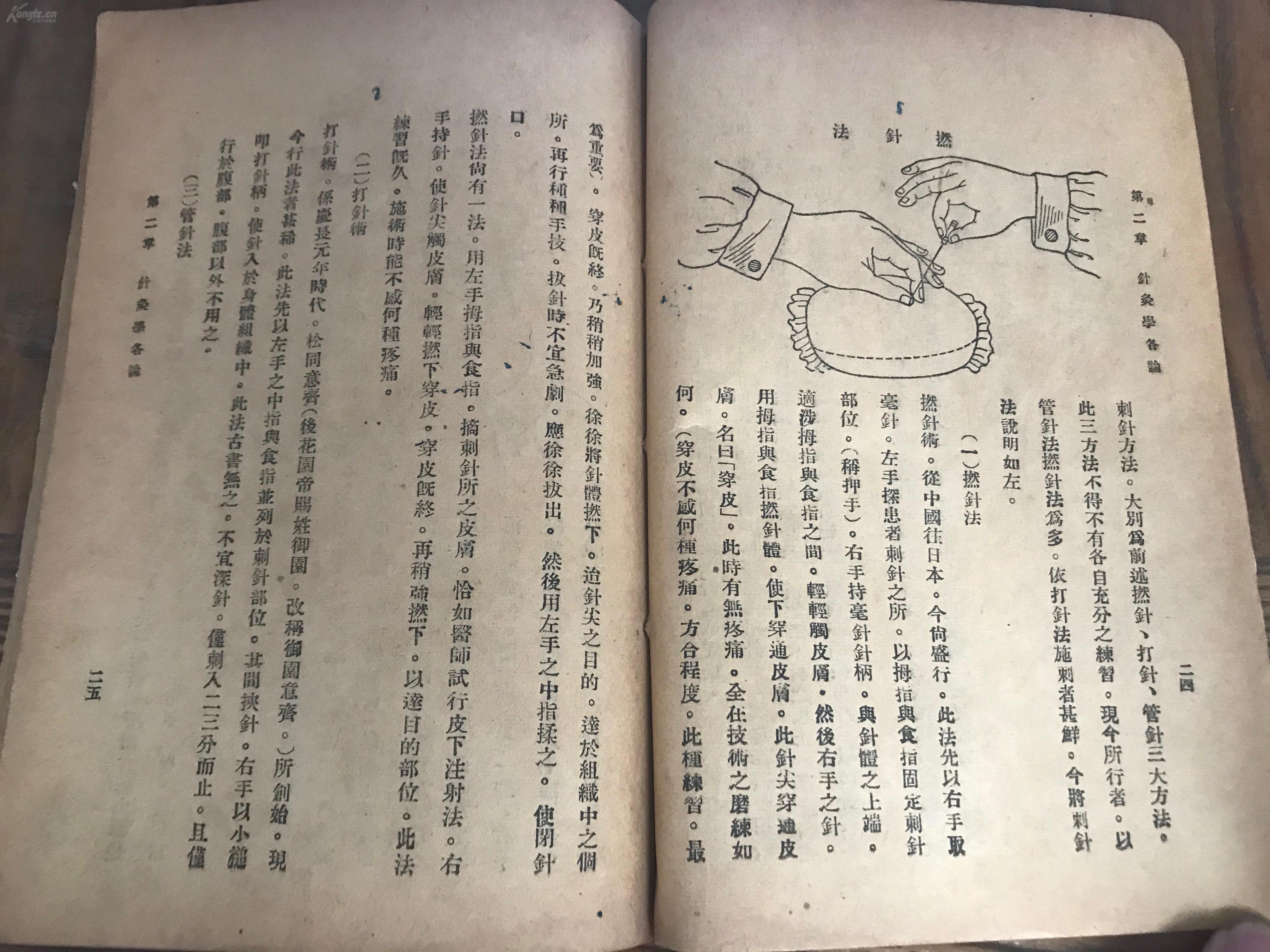 民国二十年初版(非卖品)《高等针灸学讲义》一册.该书
