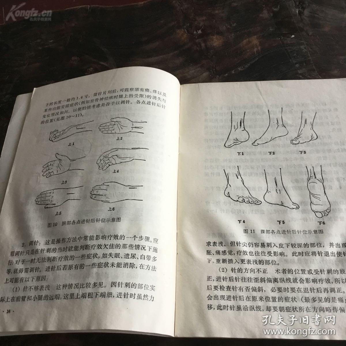 【正版老医书】一一腕踝针——针刺疗法发明者 张心曙
