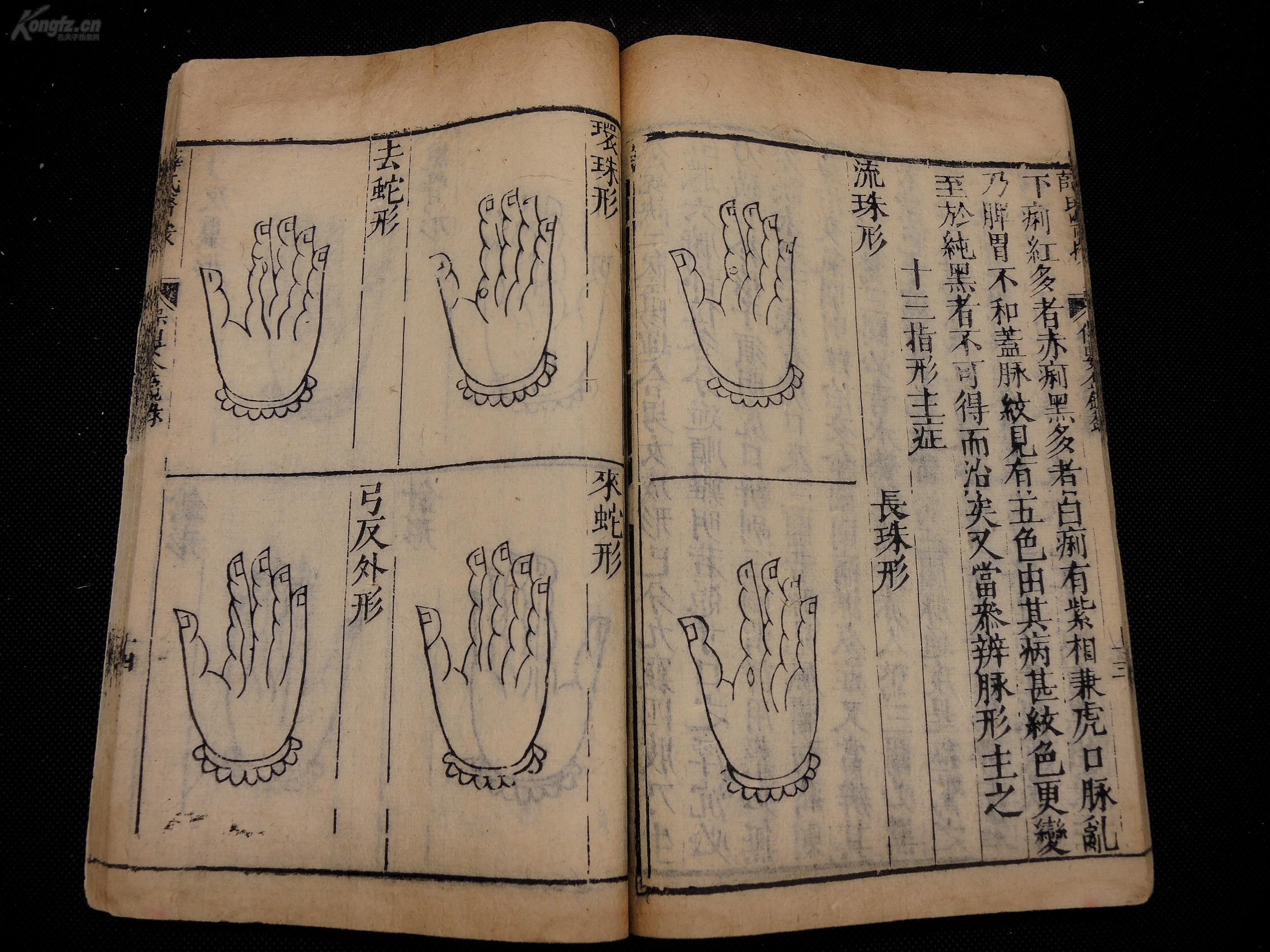 近代医学大家,医书收藏第一人范行准旧藏】明万历吴中衍精刻《保婴