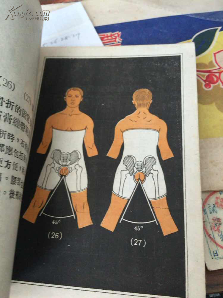 各部骨折固定姿势和石膏绷带范围图谱 (彩图绘画本 27图 1947年初版)