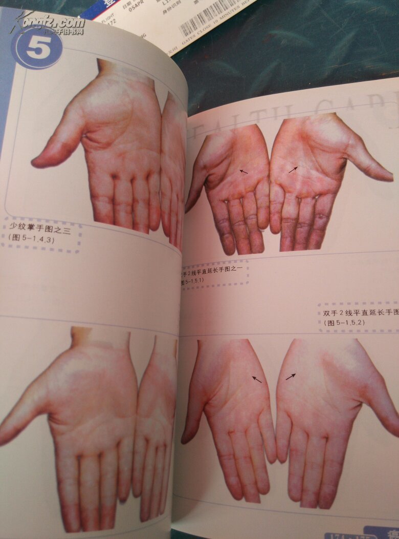 癌症看掌纹.