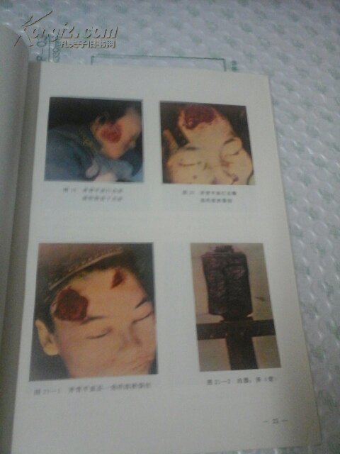 【图】法医学机械性损伤图谱_价格:10.00