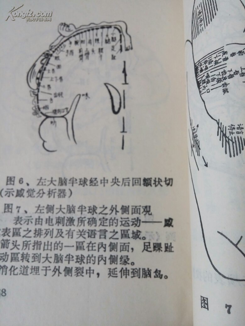 头针疗法