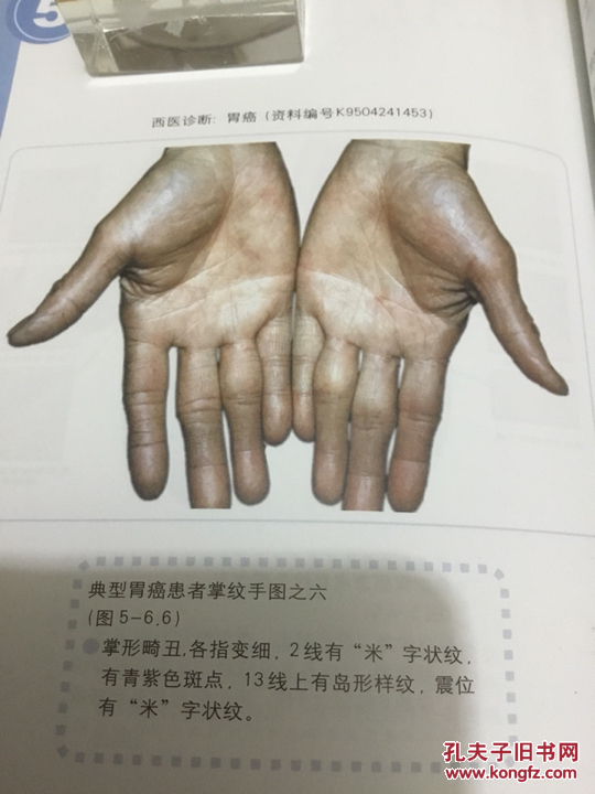 癌症看掌纹 一版一印>