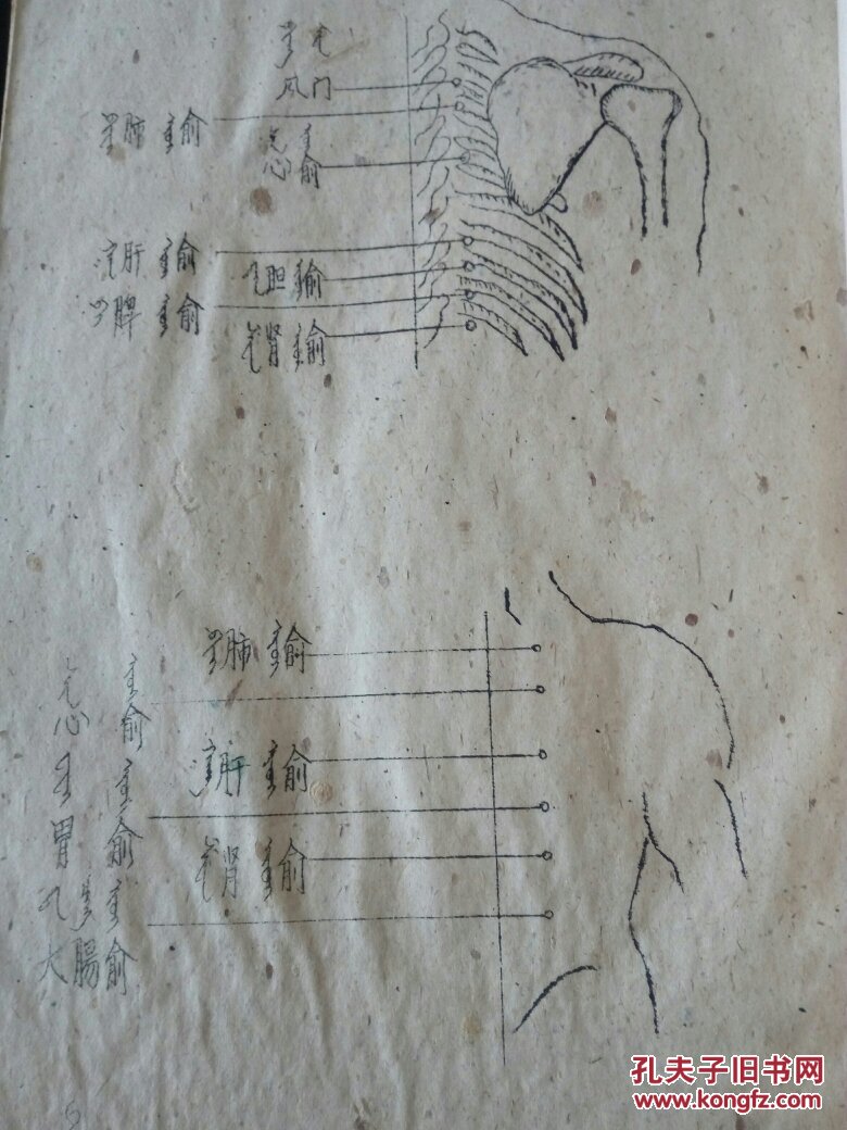 老土纸 蒙文 油印本:中医针灸学