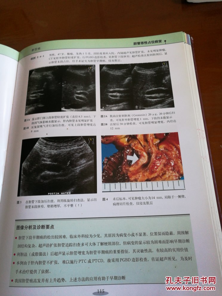 腹部疾病超声图谱