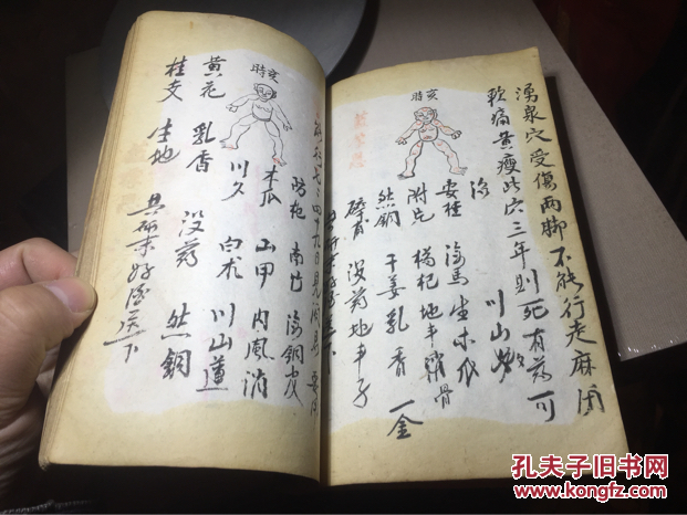 江西医学世家祖传民国七年手抄秘方一厚,有炙脉用穴人图,跌打损伤,廿