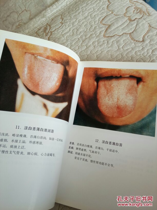 中医舌苔图谱