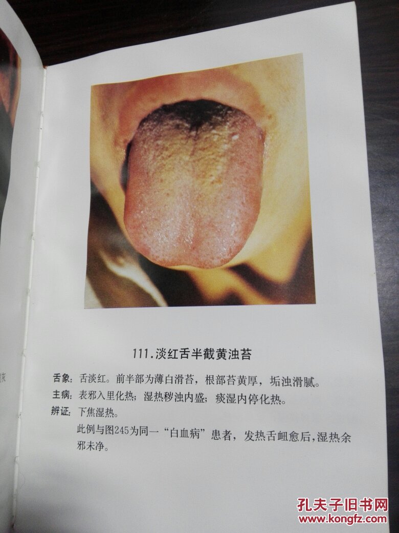 中医舌苔图谱 (宋天彬著) 共257张实拍舌苔彩图