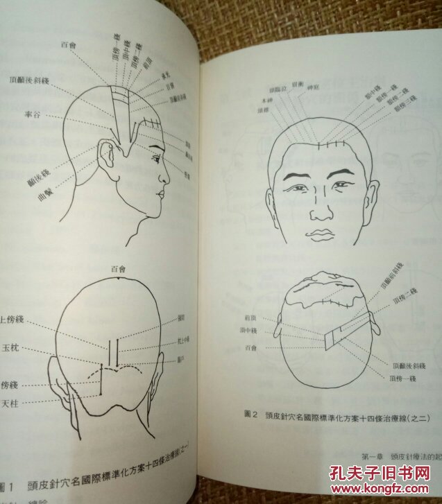 图 朱氏头皮针 朱明清 勤力书店