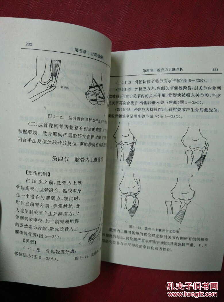 正骨图解