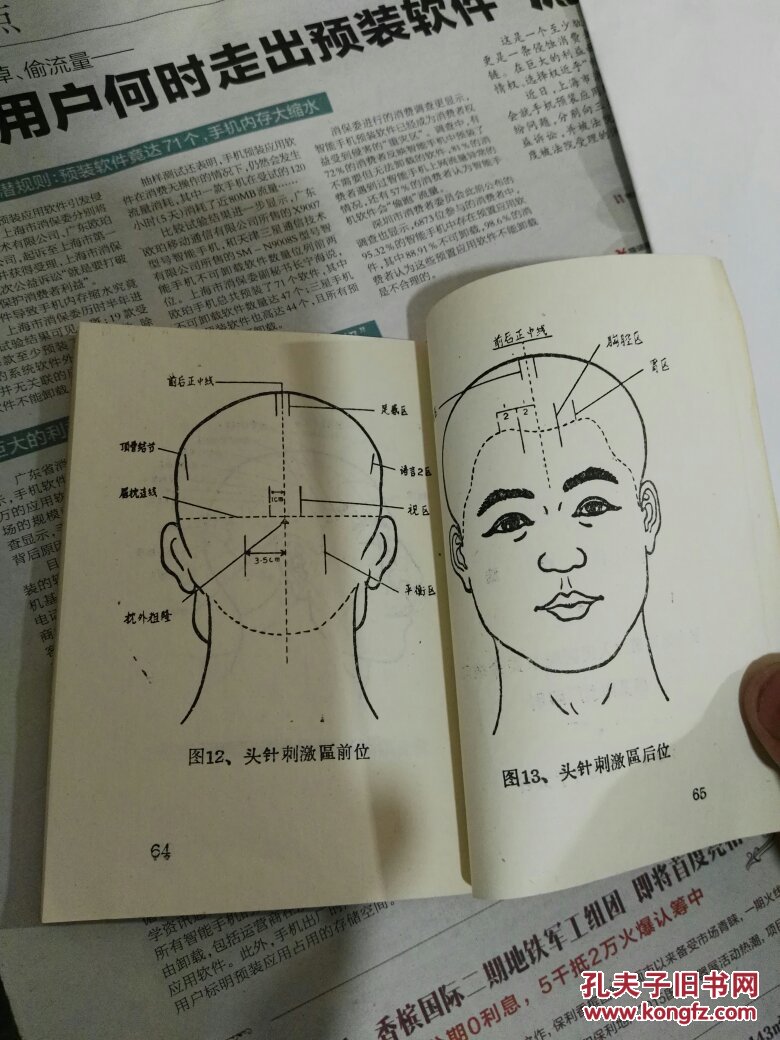 头针疗法～少见～包快递