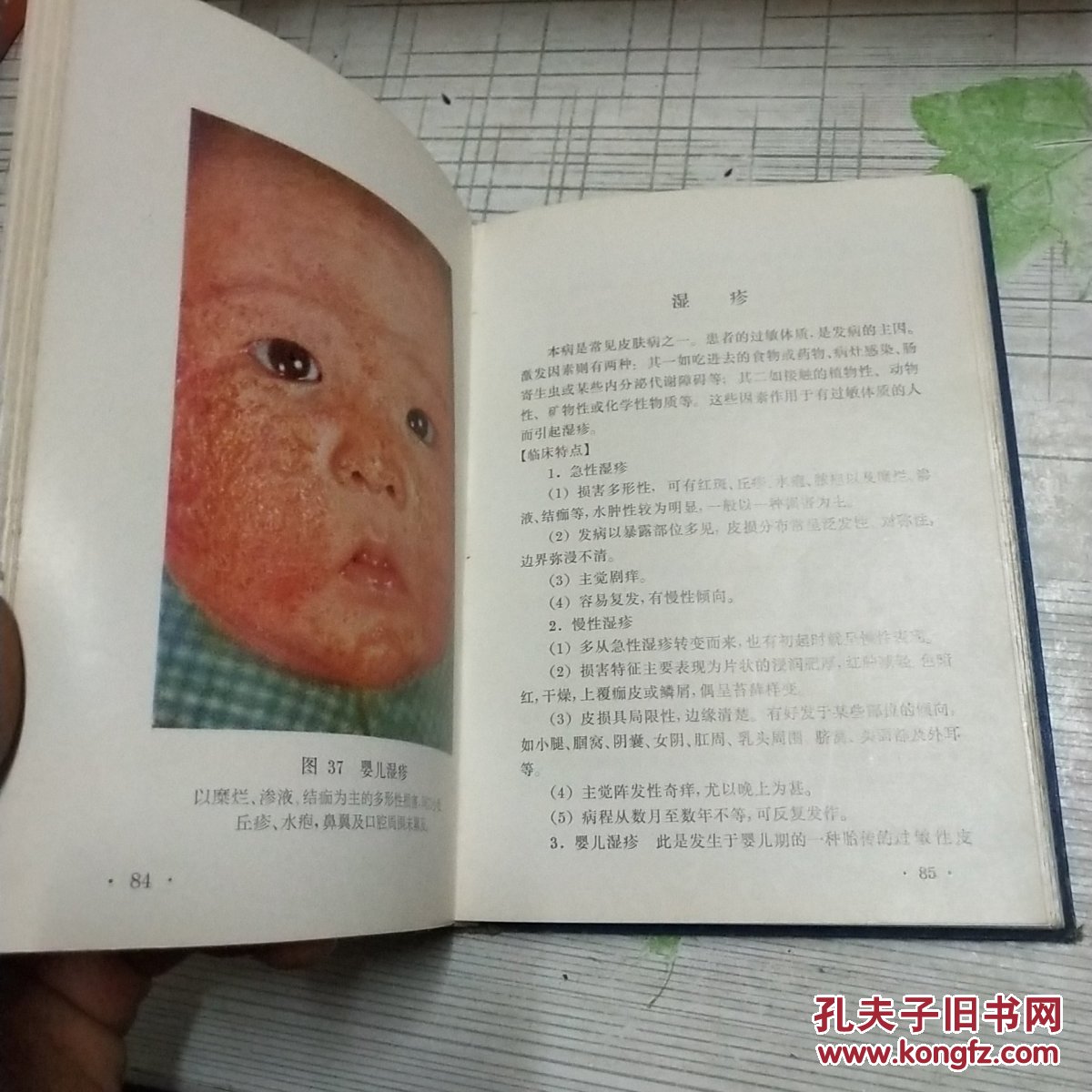 常见皮肤病图谱