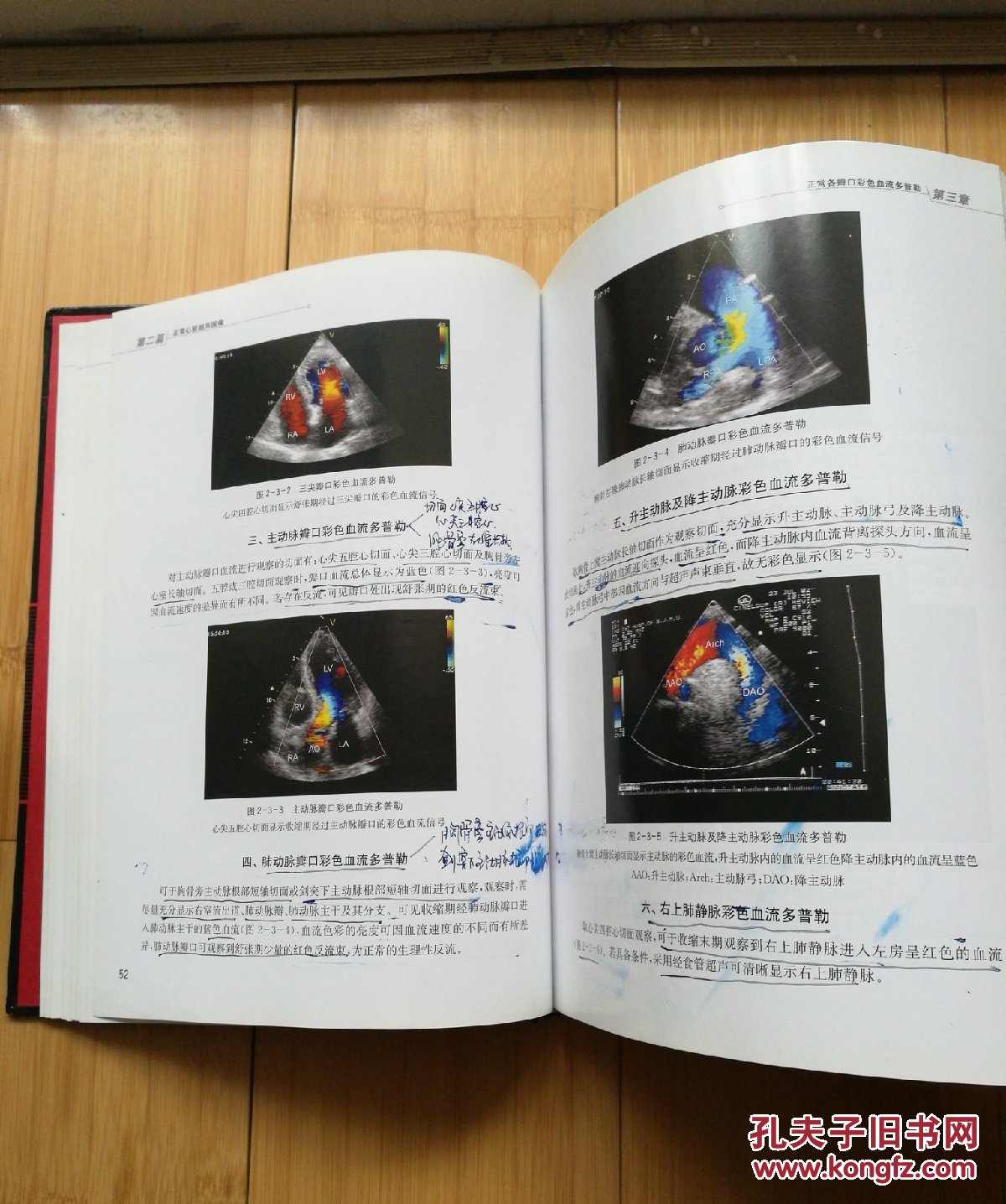 超声心动图入门