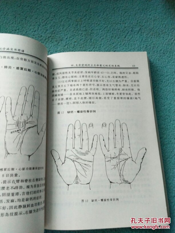 掌纹诊病实用图谱