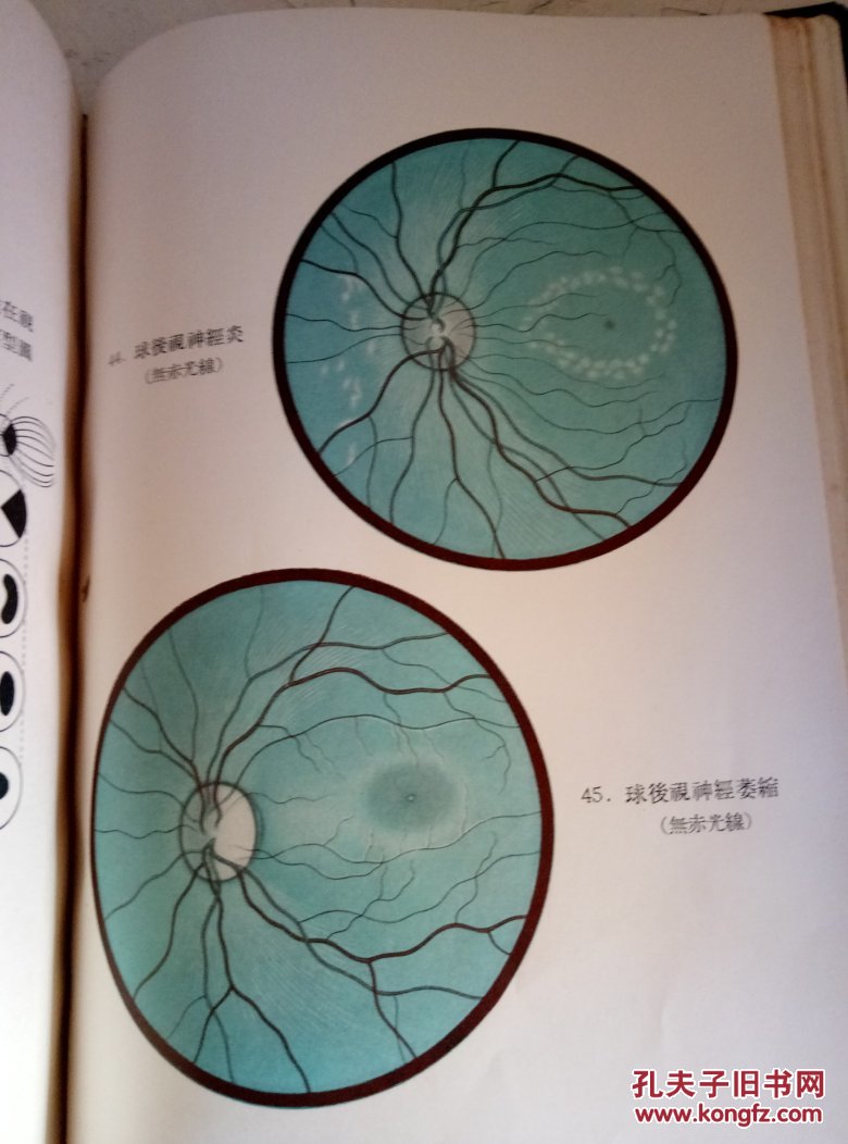 眼底病图谱. 上,下册