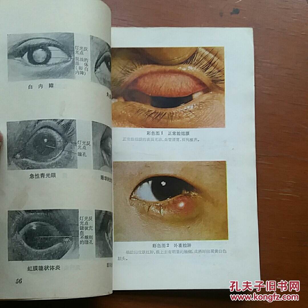 常见眼病的防治