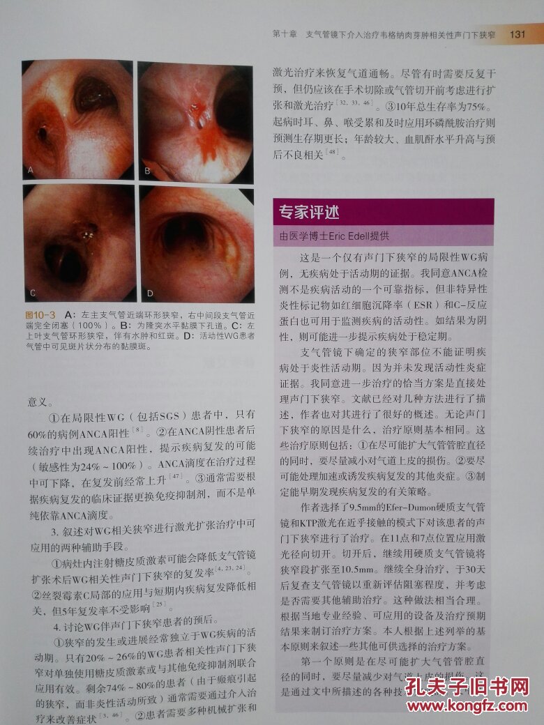 支气管镜技术与中央气道病变----以患者为中心的解决方案 精装 缺光盘