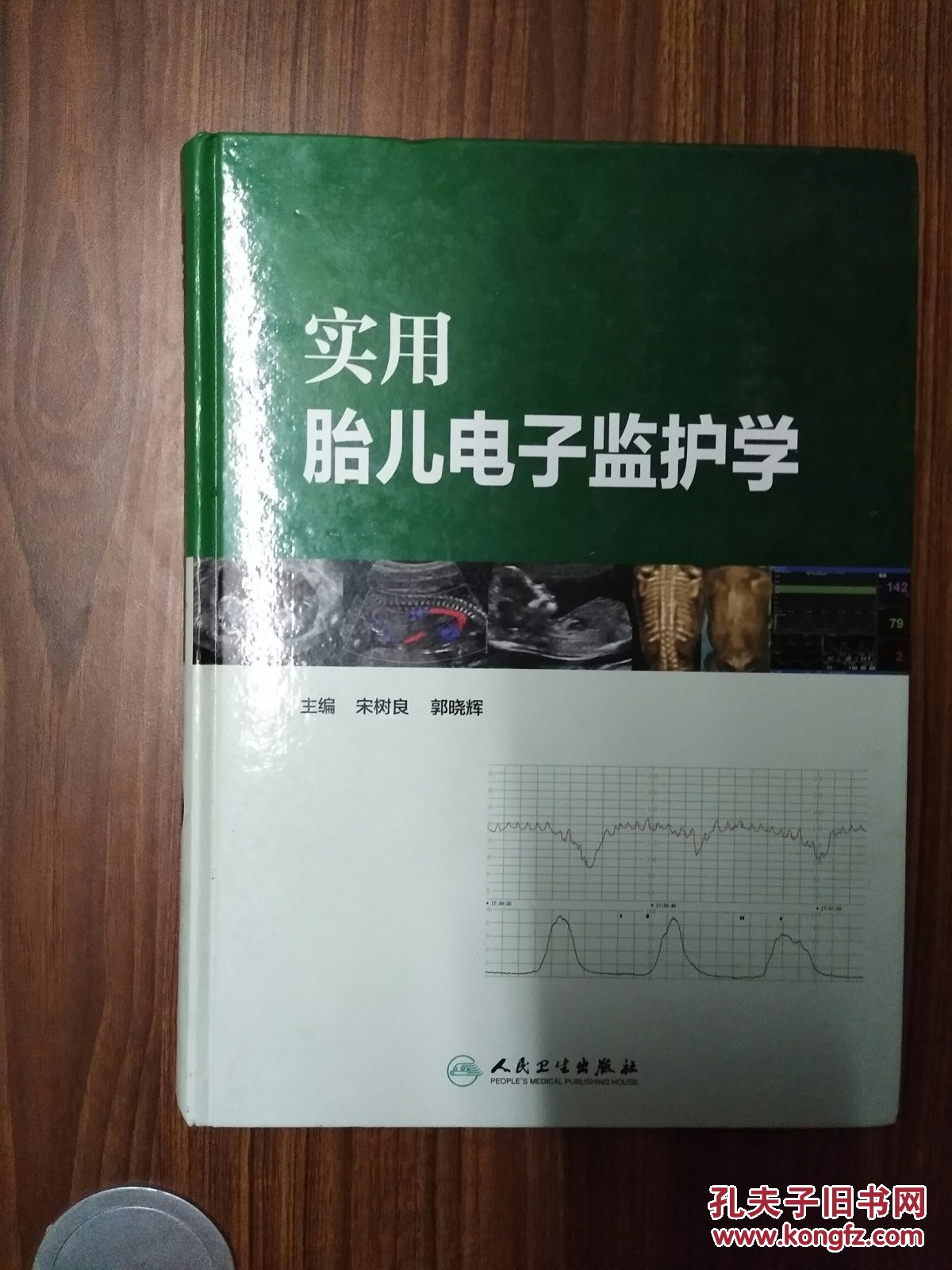 实用胎儿电子监护学