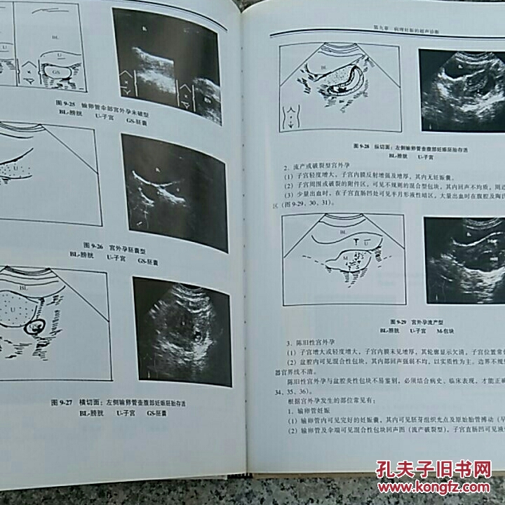 临床妇产科超声诊断学