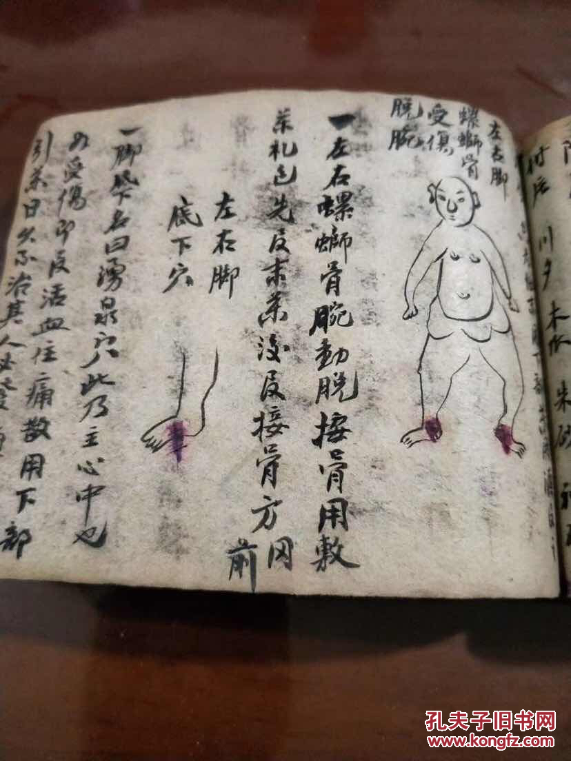 江西丰城武家祖传跌打损伤药书小开本90个筒子页左右内容精审图文并茂