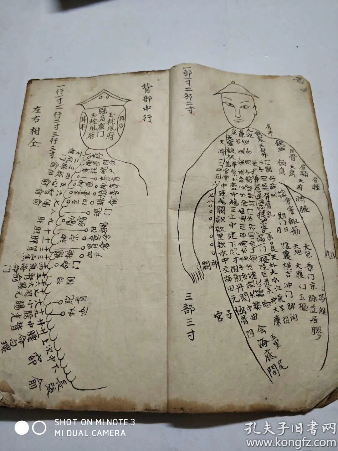 江西老中医散出祖传针灸穴位 医书线装手抄本一厚册,精写本,缺封面
