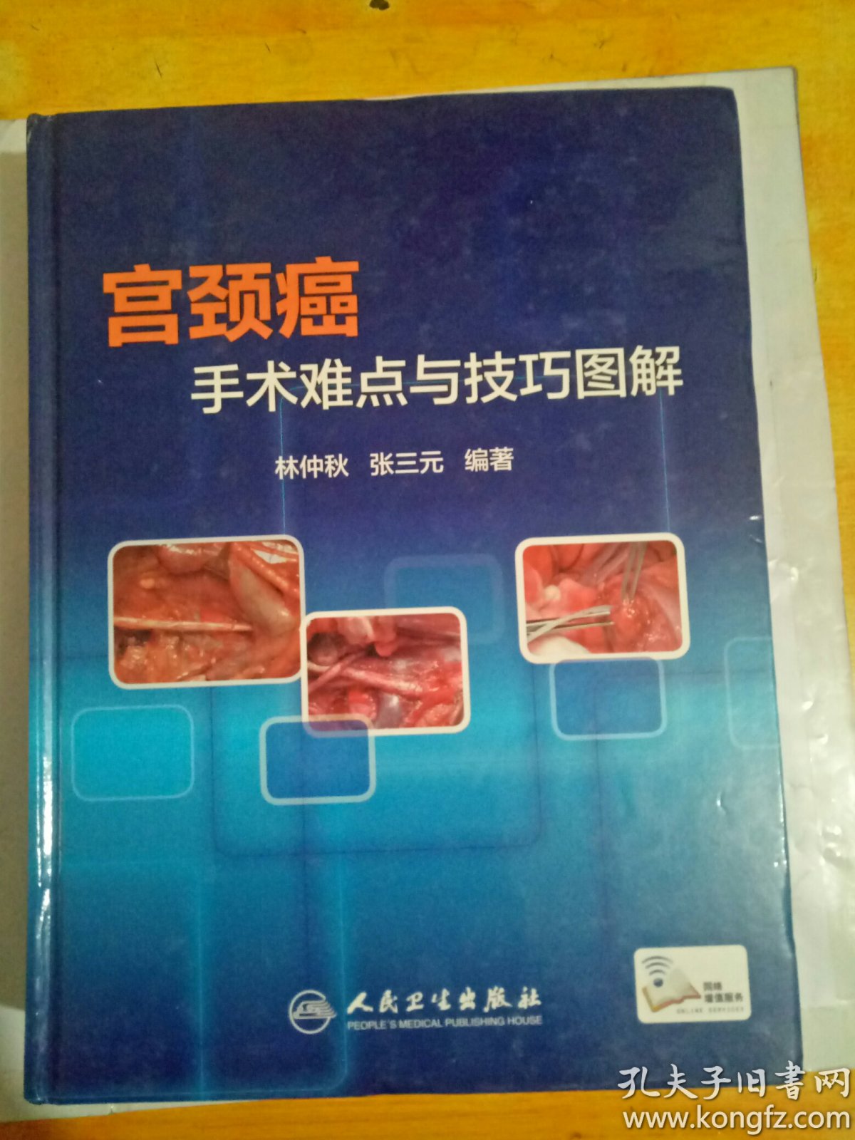 宫颈癌手术难点与技巧图解(林仲秋签名盖章本