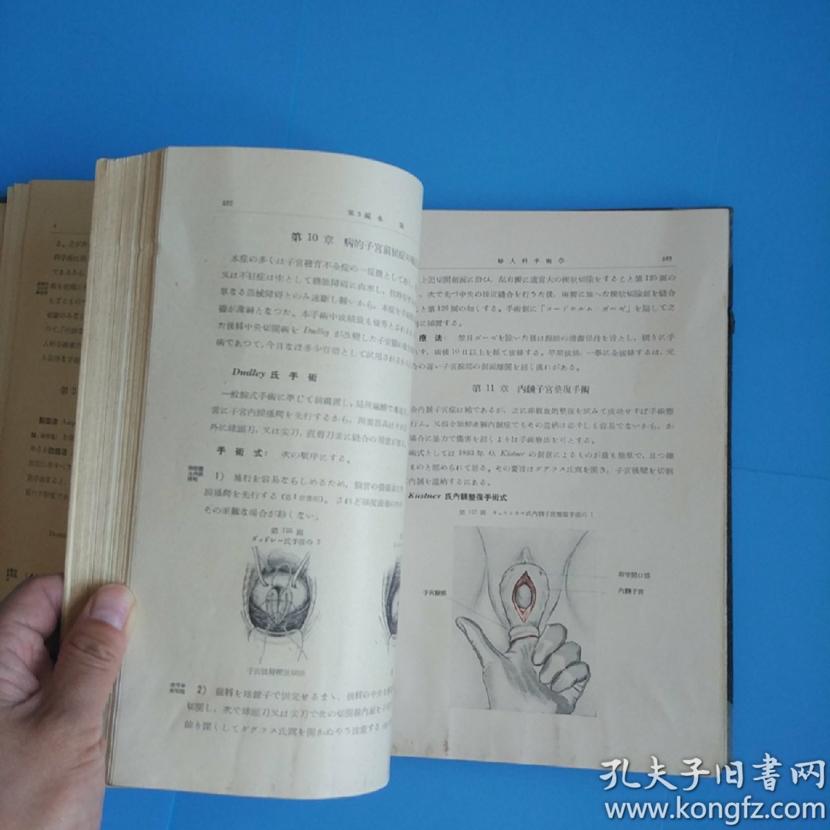 妇人科手术学(日文原版16开精装大量黑白彩色图片昭和
