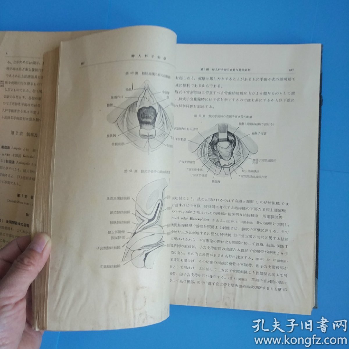 妇人科手术学(日文原版16开精装大量黑白彩色图片昭和
