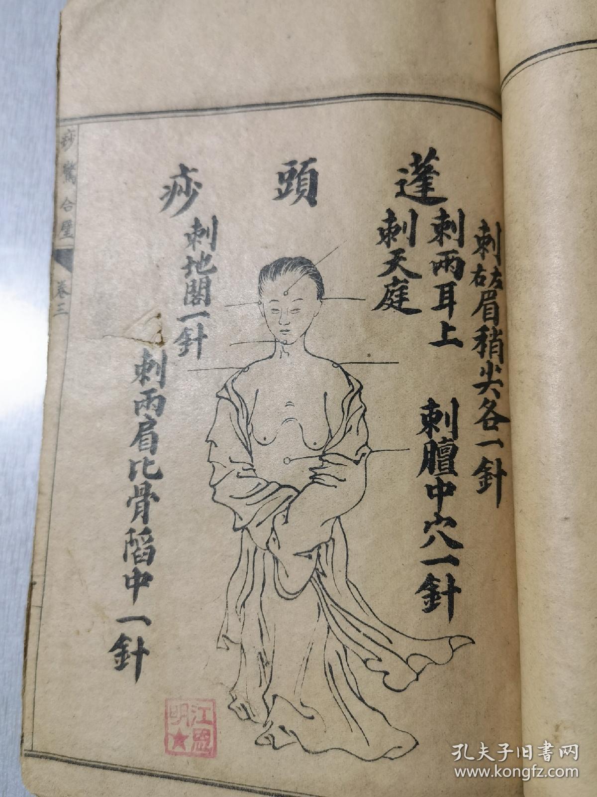 民国石印增图痧惊合璧四卷合订一册全