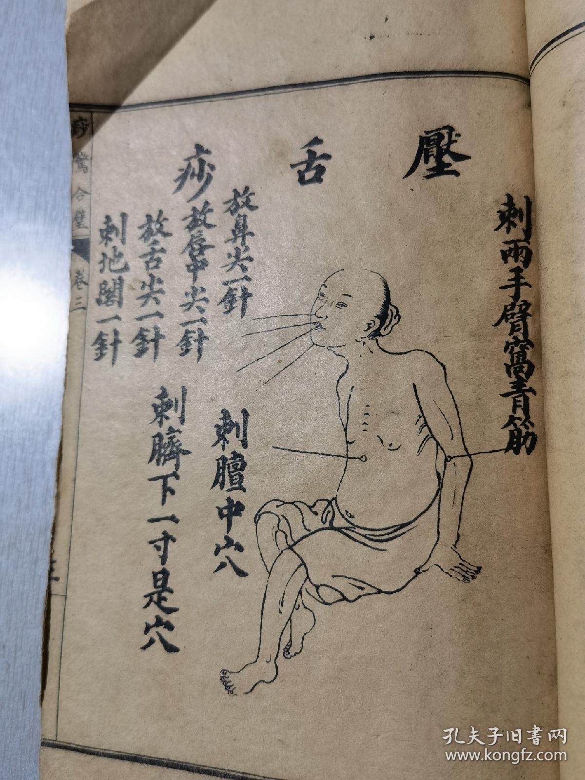 民国石印增图痧惊合璧四卷合订一册全