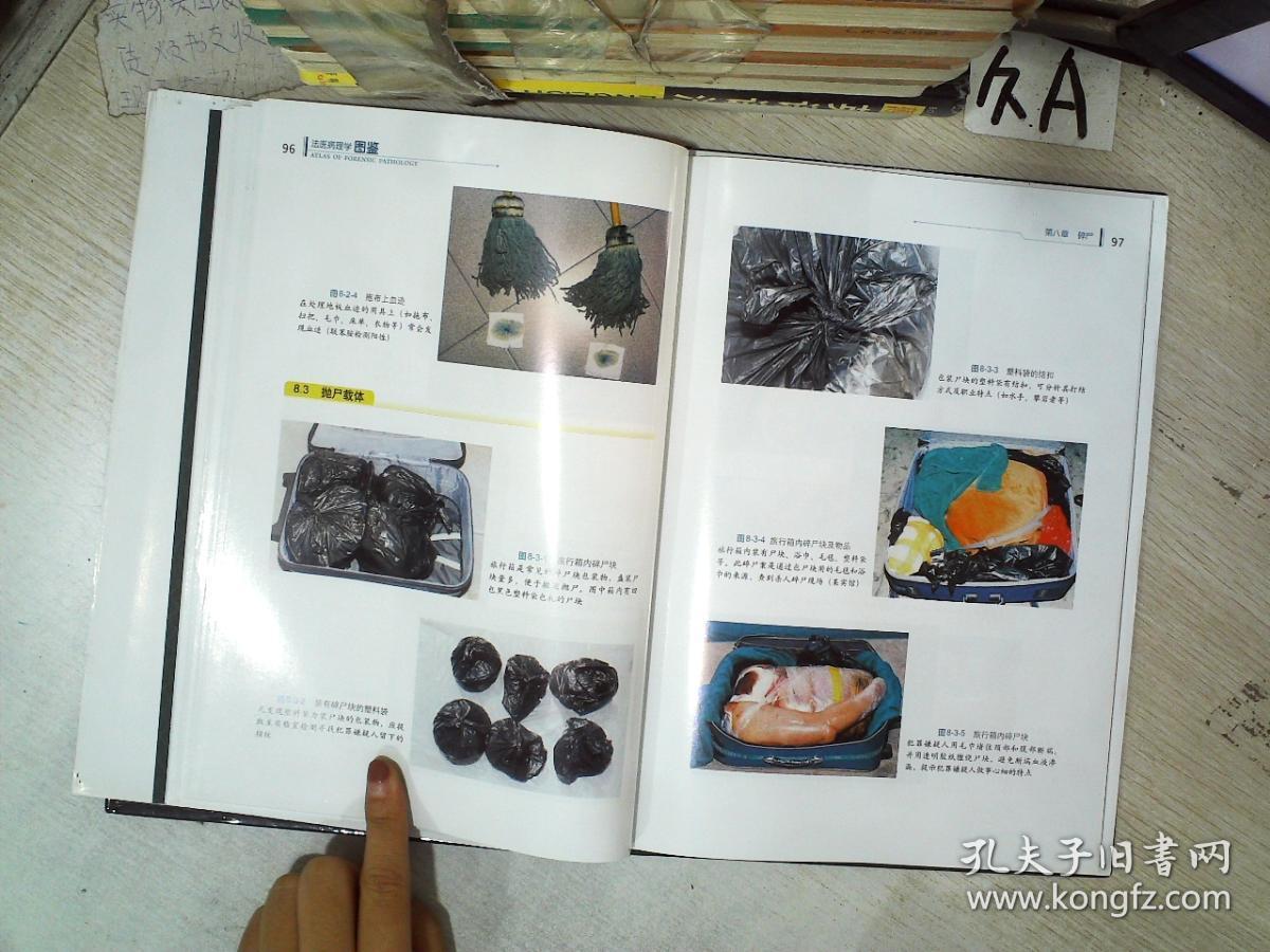 法医病理学图鉴