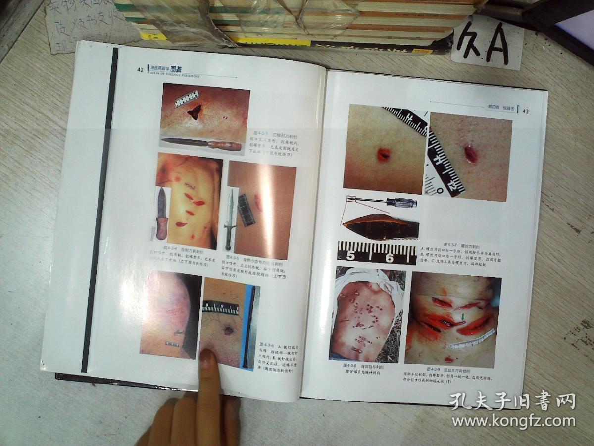 法医病理学图鉴