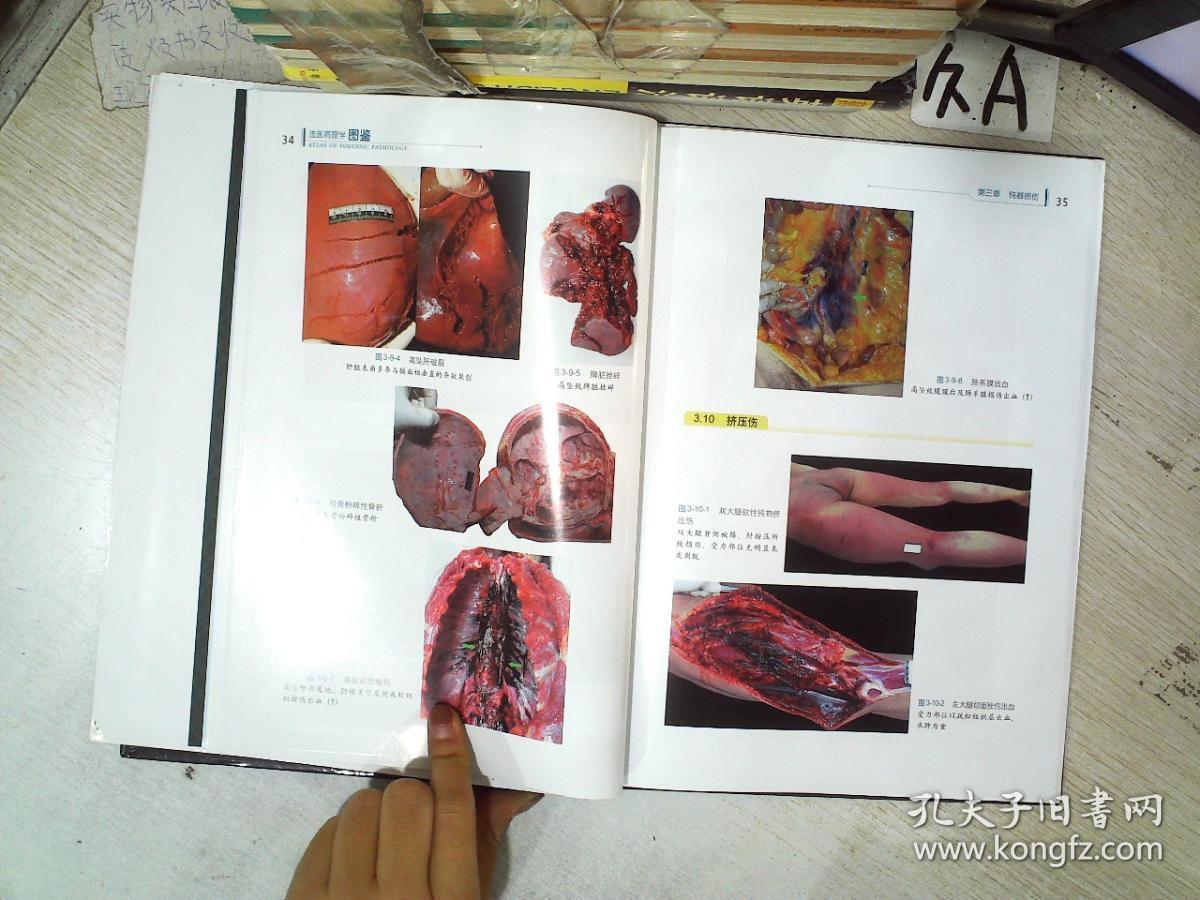 法医病理学图鉴
