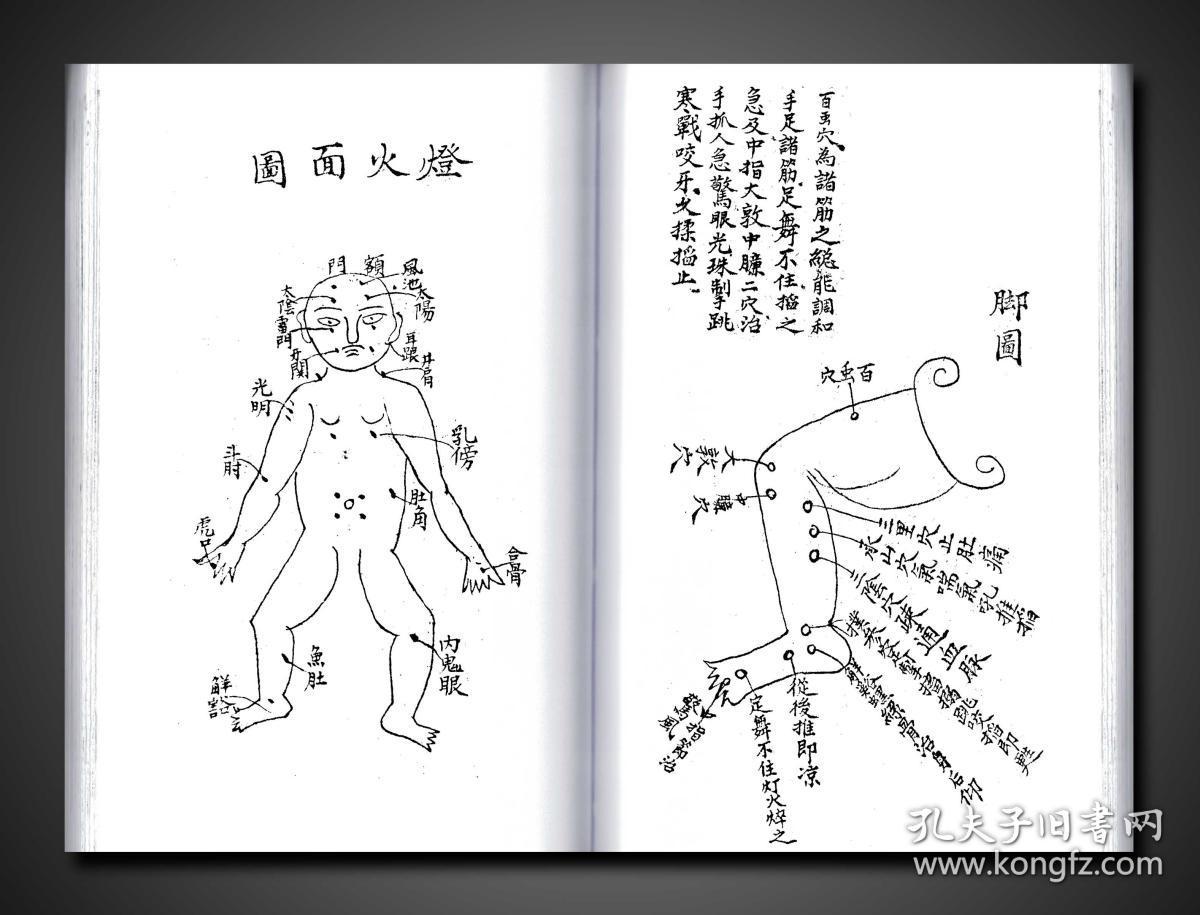 复印件三十六舌小儿惊风秘传多幅手绘精美人像图共二十二面内容五行