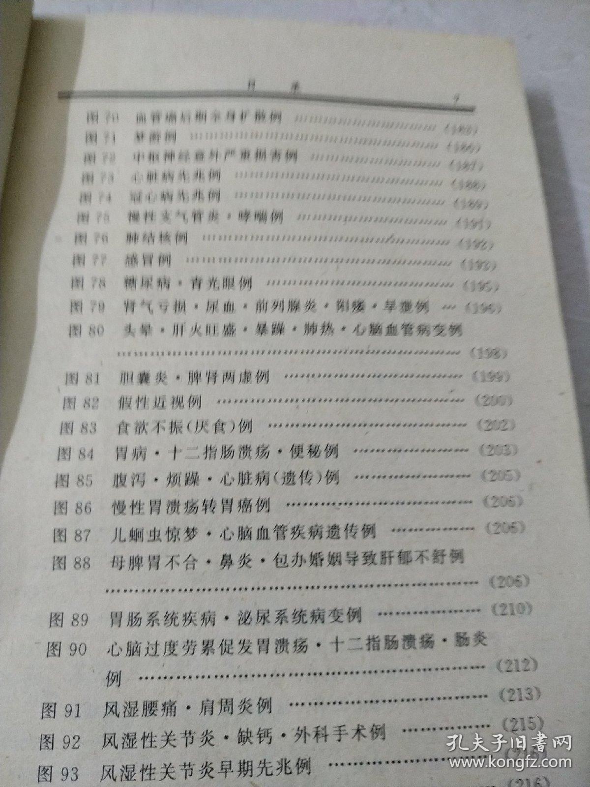 掌纹简谱_断掌纹图片(3)