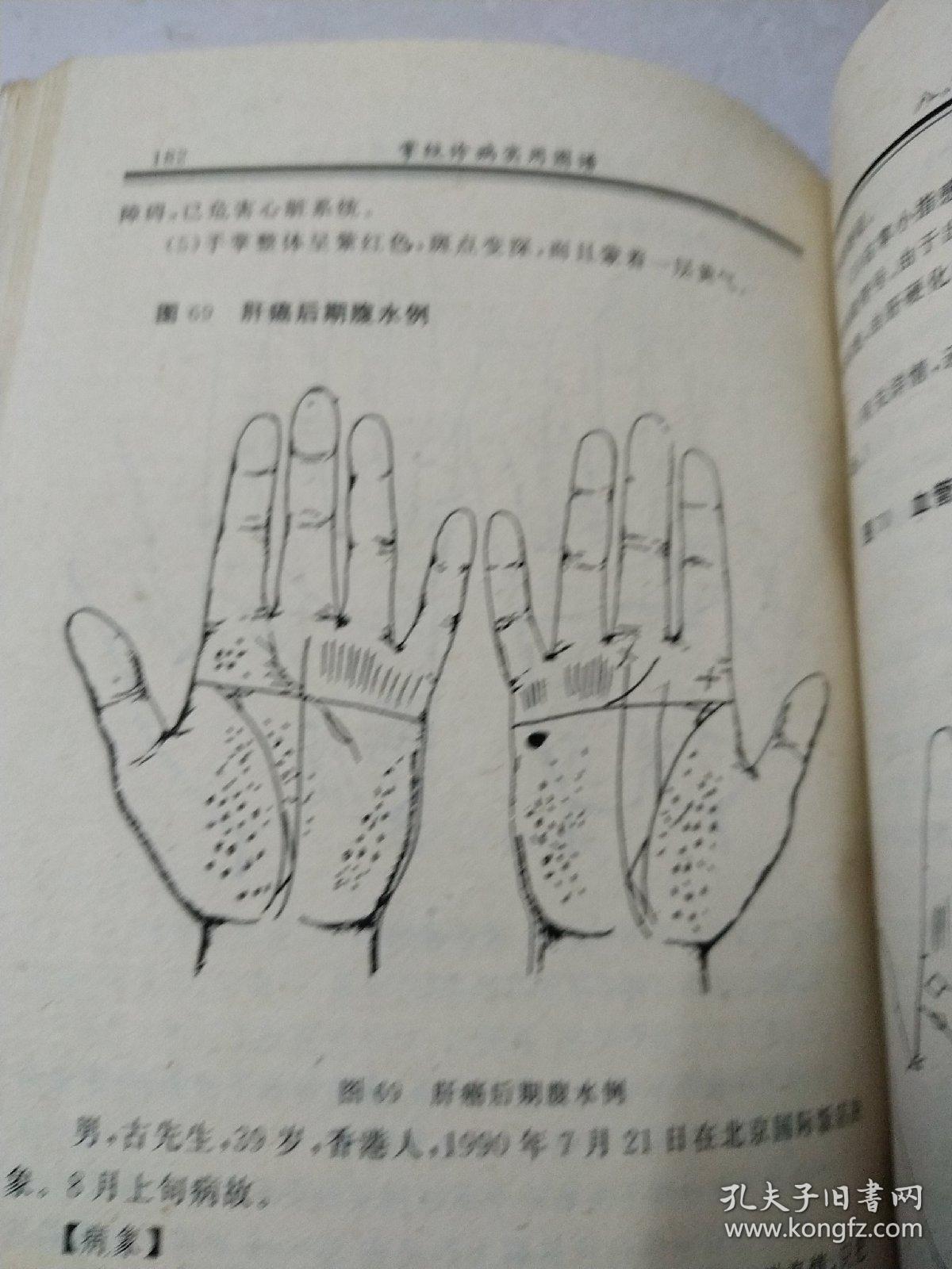 掌纹曲谱_断掌纹图片(3)