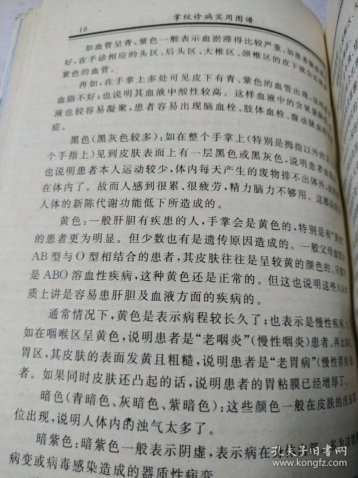 掌纹曲谱_断掌纹图片(3)