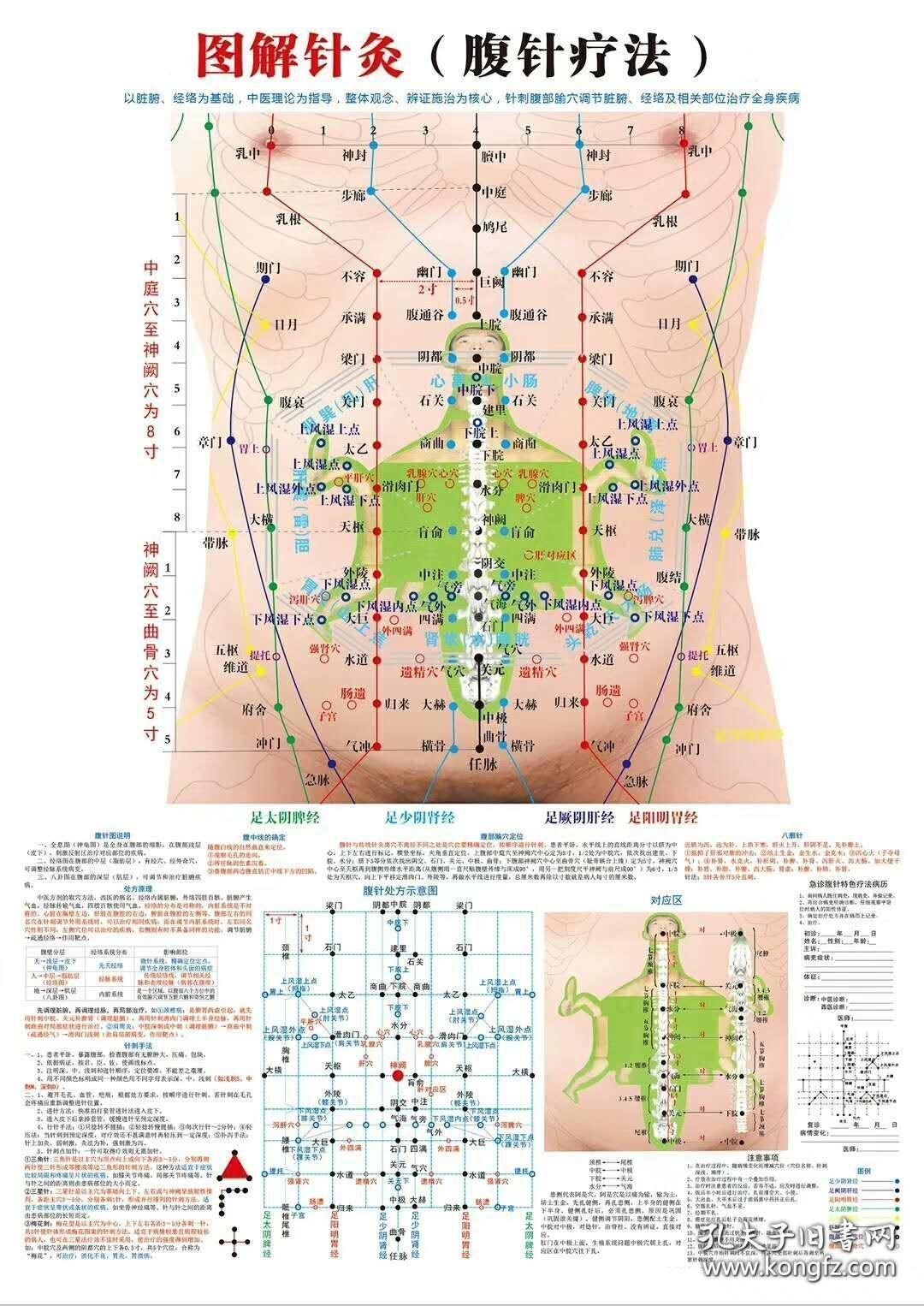 图解针灸(腹针疗法) 高清技术大挂图,贴在墙上站在一米之外能看的清楚