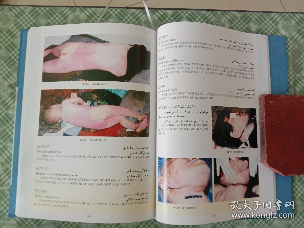 罕见新疆版精装《汉英维哈法医病理学图解词典》.低价